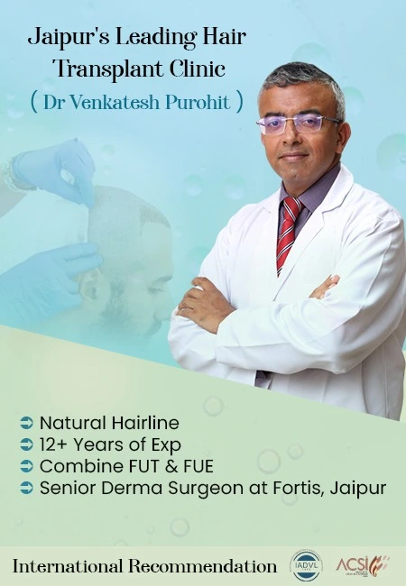 Best and Affordable Hair Transplant in Jaipur