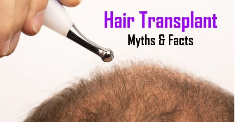 Myths and Facts About Hair Transplant in Jaipur – Best Hair Specialist Dr. Venkatesh Purohit