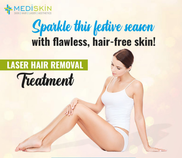 laser hair removal treatment