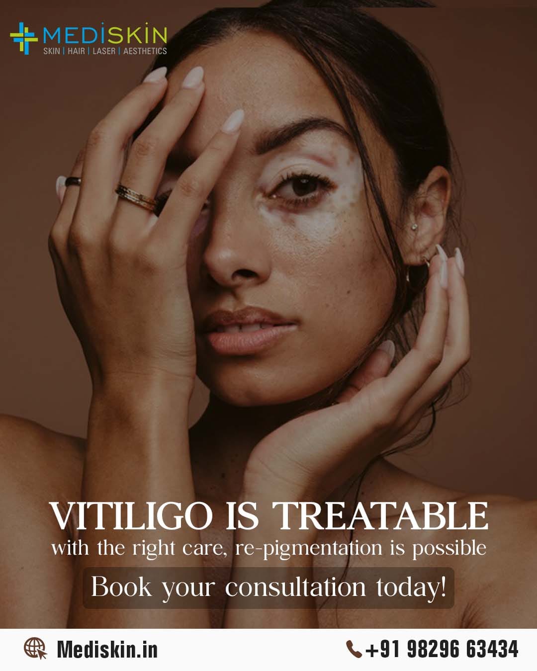 Effective Pigmentation Treatment in Jaipur: Achieve Clear, Radiant Skin at Mediskin