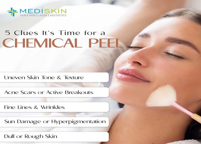 5 Clear Signs You Need a Chemical Peel for Healthier Skin