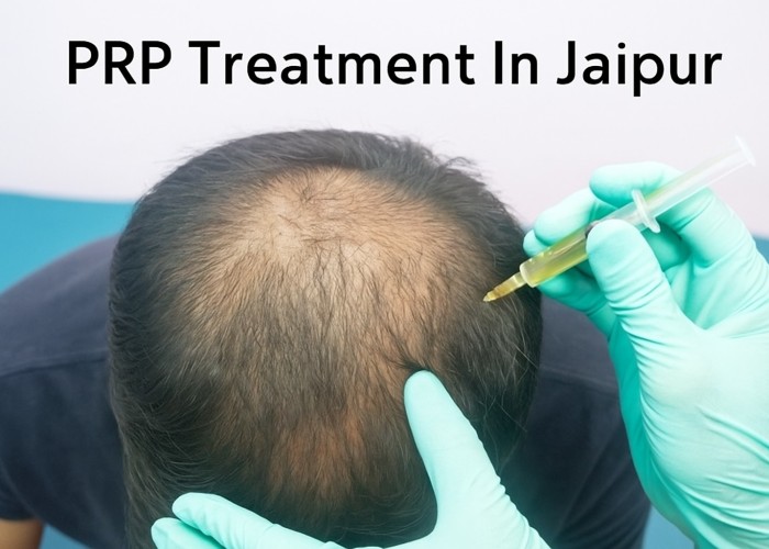How PRP Therapy Transforms Skin and Hair in Jaipur’s Climate