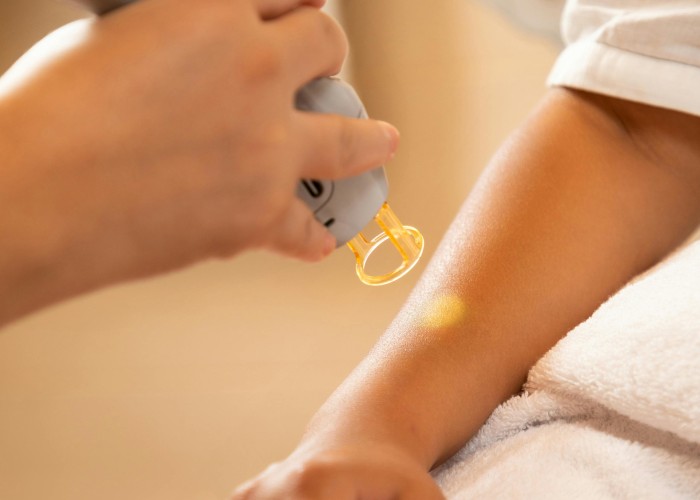 Your First Laser Hair Removal in Jaipur Made Easy: A Complete Guide by MEDISKIN