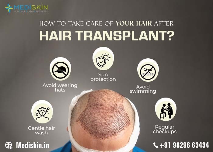 Your Ultimate Guide to Post-Hair Transplant Care: Nurturing Your New Hair for Lasting Results