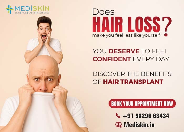 Does Hair Loss Make You Feel Less Like Yourself? Discover the Benefits of Hair Transplant